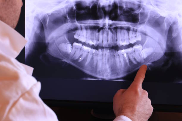 Best Emergency Treatment for Jaw Pain or Injury in Walnut Grove, CA